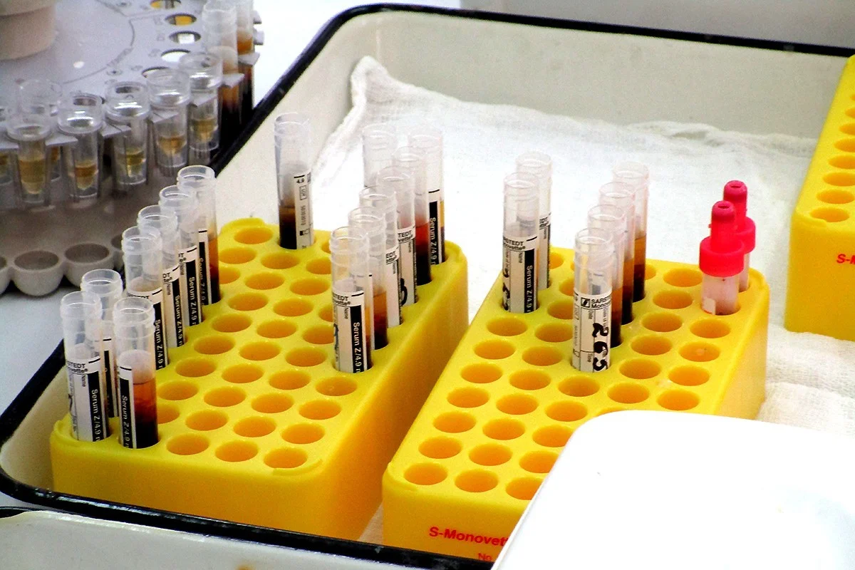 В Калининградской области стартует исследование популяционного иммунитета к COVID-19