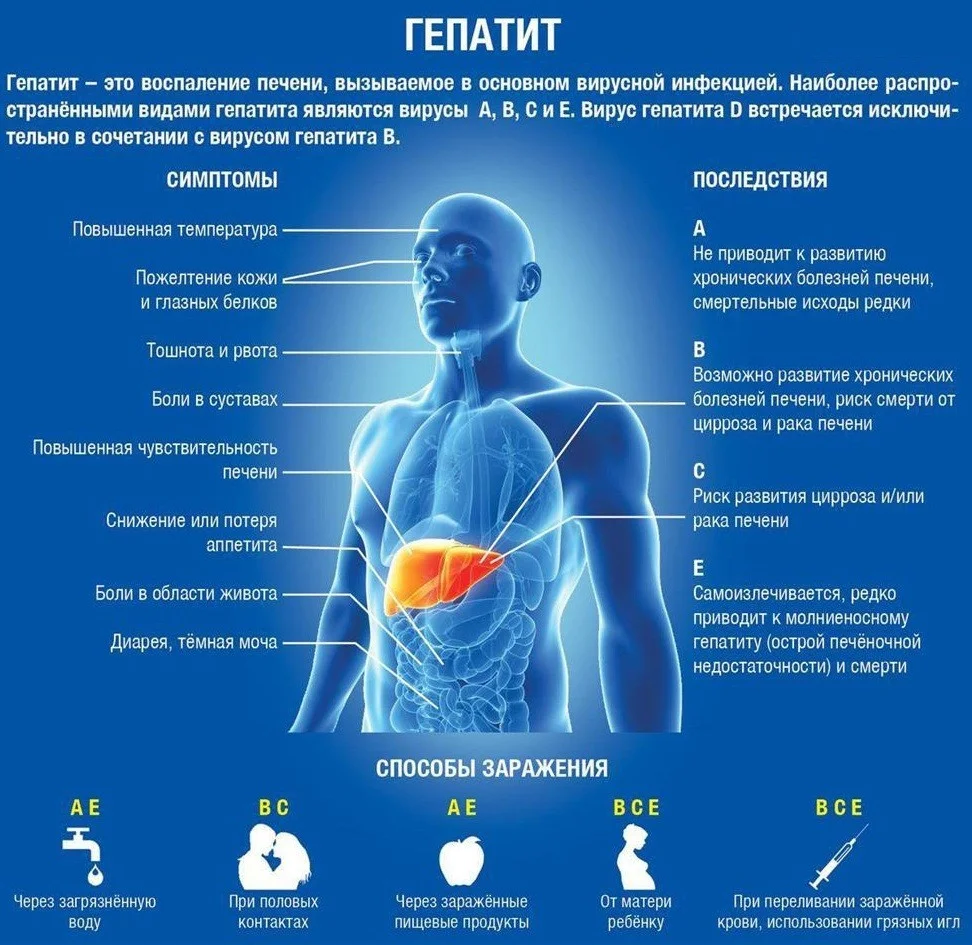 ГЕПАТИТЫ