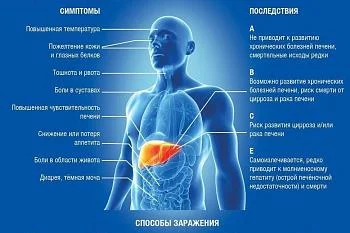 ГЕПАТИТЫ